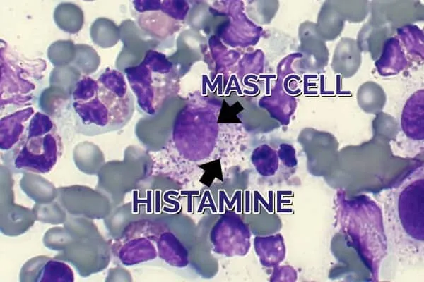 Microscopic view of mast cells. Photo credit: Dr. Kate Schlicher Baker.