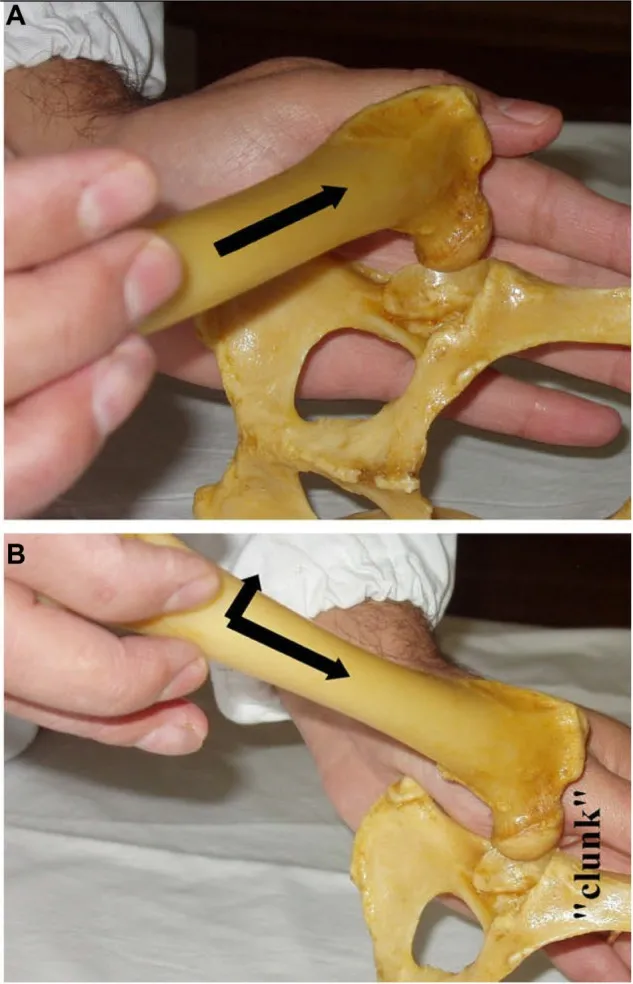 Veterinarian performing the Ortolani test on a dog in lateral recumbency to check for canine hip dysplasia (CHD) and hip joint laxity, showing the displacement and reduction of the femoral head.