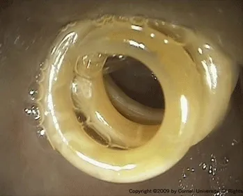 Visual representation of roundworms (ascarids) in a dog's digestive tract, highlighting their parasitic presence.
