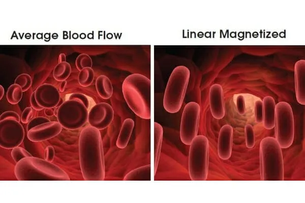 Diagram illustrating the difference between average blood flow and linearly magnetized blood flow