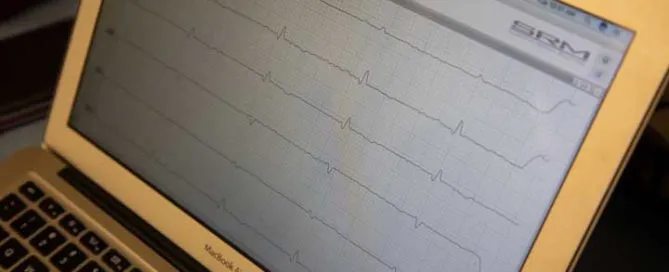 EKG Reading On Computer Screen