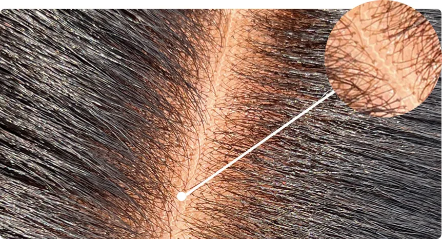 Enlarged detail showing bleached tiny knots and lace density