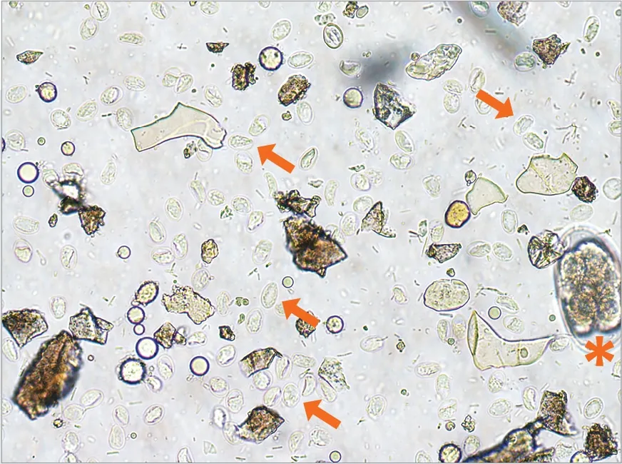 Giardia duodenalis cysts (arrows) recovered via centrifugal fecal flotation with zinc sulfate; hookworm egg (asterisk) for scale.