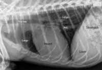Labeled X-ray of a normal heart