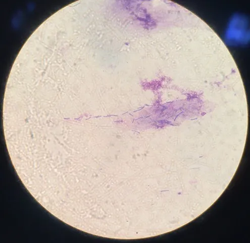 Long filamentous Gram-positive organisms from budgerigar fecal cytology consistent with Macrorhabdus ornithogaster
