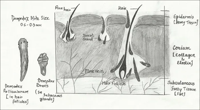 Microscopic view of a Demodex mite residing within a human hair follicle
