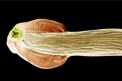 Roundworm (Toxocara canis) anterior view, showing the characteristic cervical alae.